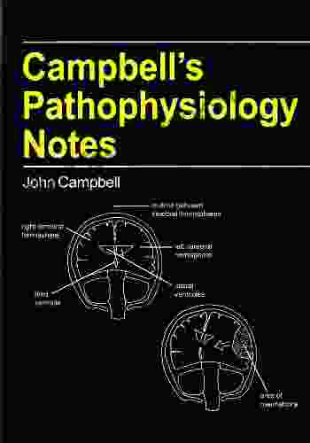 Campbell S Pathophysiology Notes (Campbell S Notes)