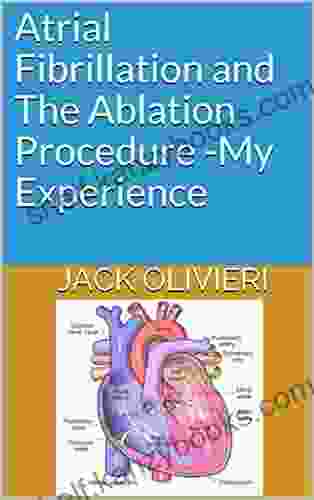 Atrial Fibrillation And The Ablation Procedure My Experience (My Experience Books)