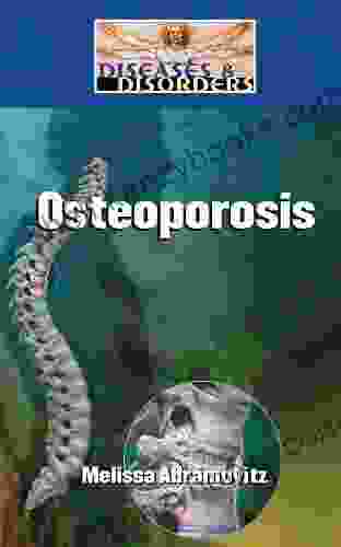 Osteoporosis (Diseases And Disorders) Melissa Abramovitz